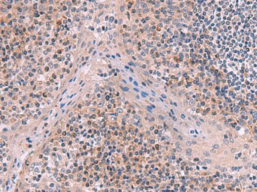 Immunohistochemistry of paraffin-embedded Human tonsil tissue using ITIH4 Polyclonal Antibody at dilution of 1:50(×200)