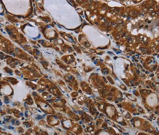 Anti-Human/Mouse/Rat MT-ND1 Antibody