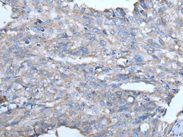 Anti-Human/Mouse/Rat GJA1 Antibody