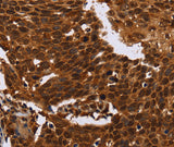 Anti-Human FANCF Antibody - ABMIUM