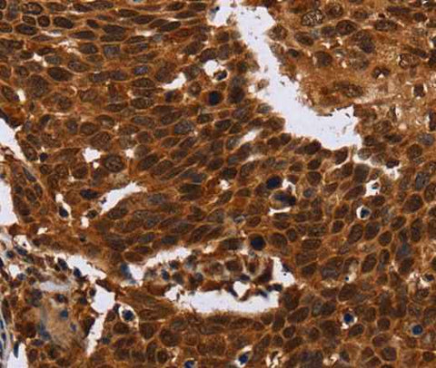 Anti-Human FANCF Antibody