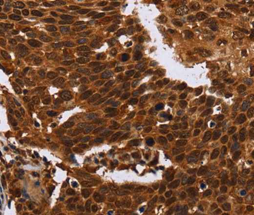 Anti-Human FANCF Antibody