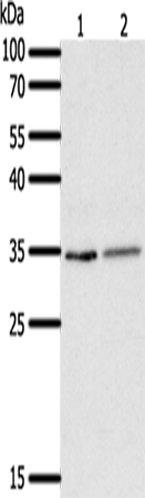 Anti-Human/Rat SFTPA1 Antibody - ABMIUM