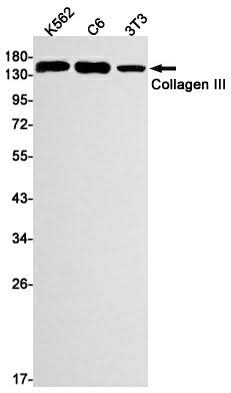 Western blot detection of Collagen III in K562,C6,3T3 cell lysates using Collagen III Rabbit mAb(1:1000 diluted).Predicted band size:139kDa.Observed band size:150kDa.