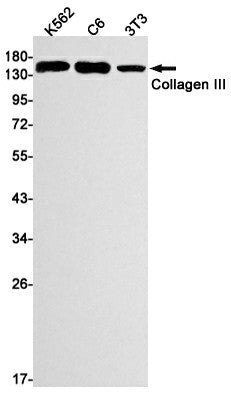 Western blot detection of Collagen III in K562,C6,3T3 cell lysates using Collagen III Rabbit mAb(1:1000 diluted).Predicted band size:139kDa.Observed band size:150kDa.