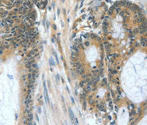 Anti-Human BAD Antibody