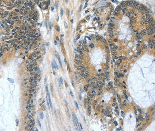 Anti-Human BAD Antibody - ABMIUM