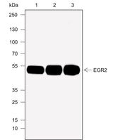 Anti-Human/Rat/Mouse EGR2 Antibody [A776] - ABMIUM