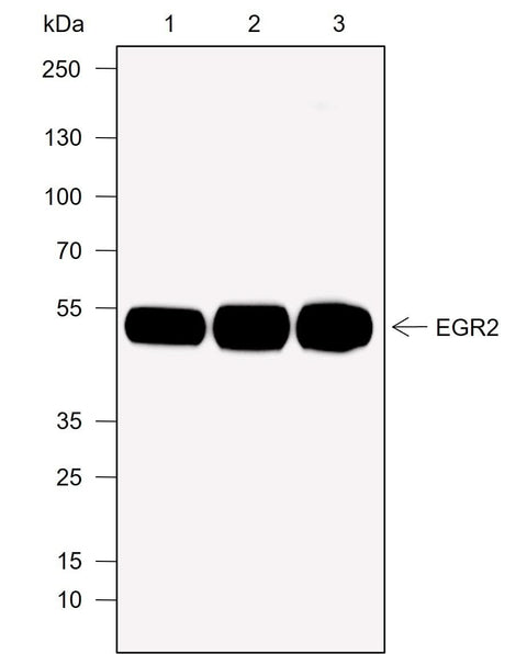 Anti-Human/Rat/Mouse EGR2 Antibody [A776] - ABMIUM
