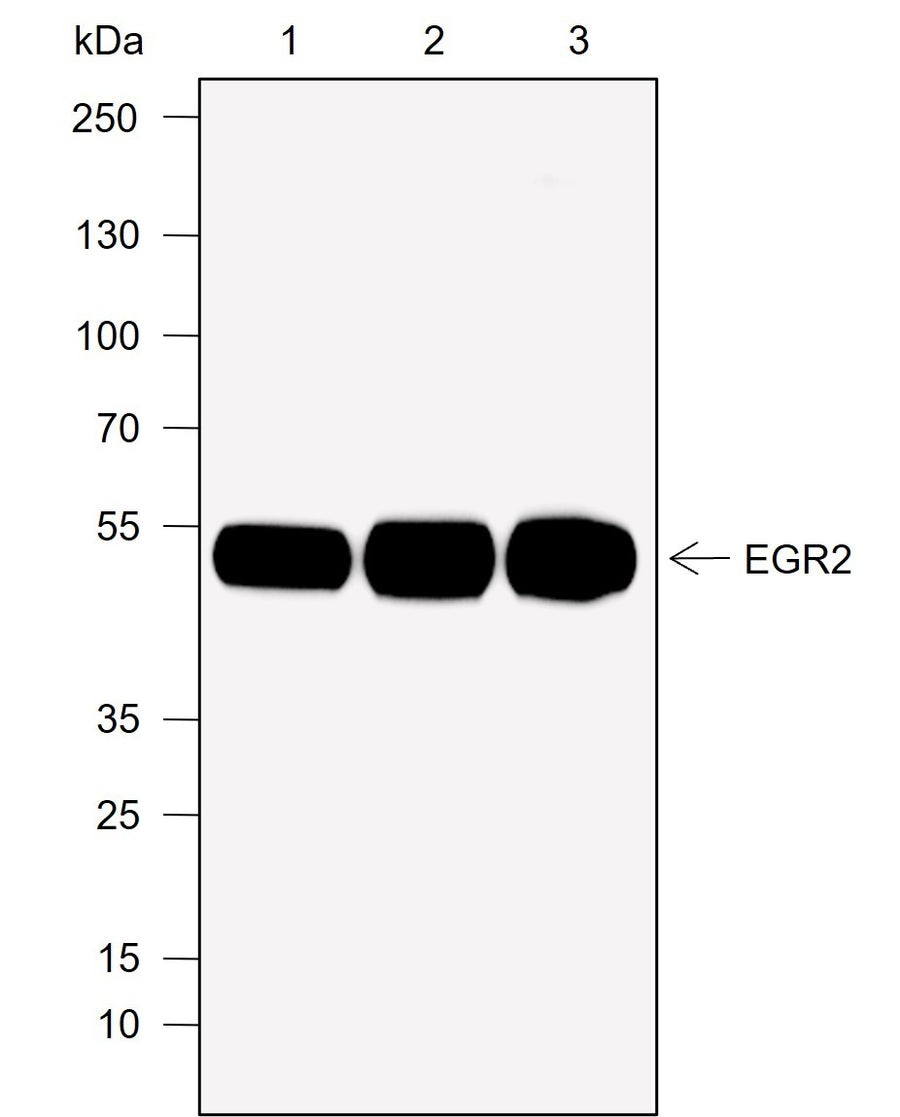 Anti-Human/Rat/Mouse EGR2 Antibody [A776] - ABMIUM