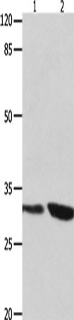 Anti-Human/Mouse/Rat YWHAG Antibody - ABMIUM