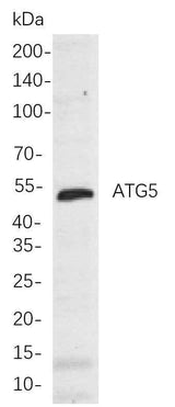Anti-Human/Mouse/Rat ATG5 Antibody [B811]