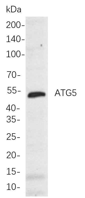 Anti-Human/Mouse/Rat ATG5 Antibody [B811] - ABMIUM