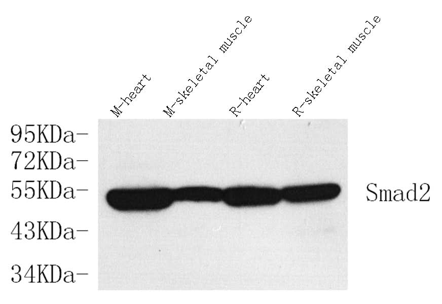 Western Blot analysis of various samples using SMAD2 Polyclonal Antibody at dilution of 1:750.