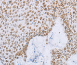 Anti-Human/Mouse MCM2 Antibody - ABMIUM