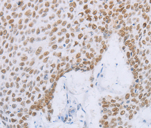 Anti-Human/Mouse MCM2 Antibody - ABMIUM