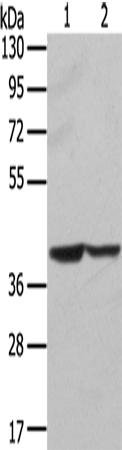 Anti-Human/Mouse STX16 Antibody - ABMIUM