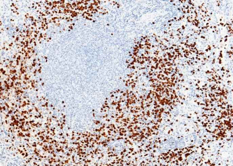 Anti-Human S100A9 Antibody [A1192] - ABMIUM