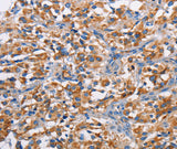 Anti-Human/Mouse PIM2 Antibody - ABMIUM