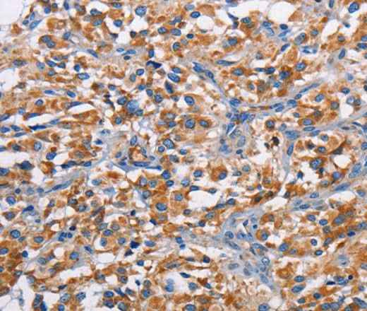 Anti-Human/Mouse PIM2 Antibody