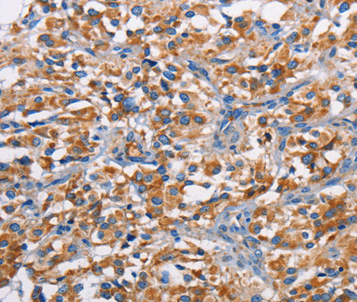 Anti-Human/Mouse PIM2 Antibody - ABMIUM