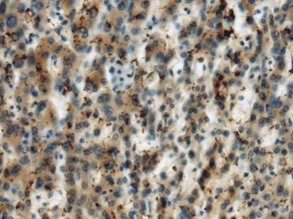 Anti-Human MICA Antibody