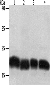 Anti-Human/Mouse PDCD6 Antibody - ABMIUM
