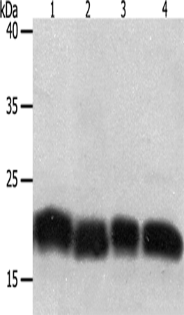 Anti-Human/Mouse PDCD6 Antibody - ABMIUM