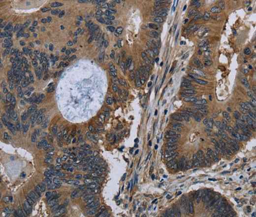 Anti-Human/Mouse/Rat TSC22D3 Antibody