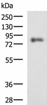 Western blot analysis of HepG2 cell lysate using PRKCSH Polyclonal Antibody at dilution of 1:1350
