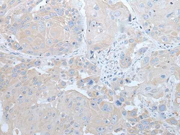 Anti-Human IFNB1 Antibody