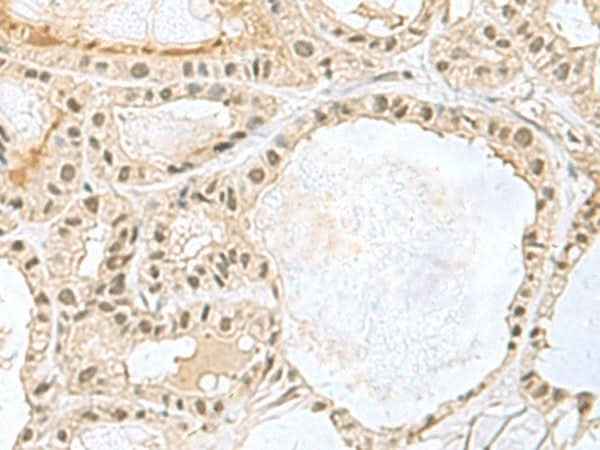 Anti-Human/Mouse KDM3B Antibody