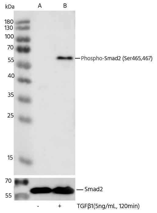 Anti-Human Smad2 Antibody [A1260] - ABMIUM