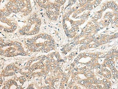 Anti-Human PCDHGB5 Antibody - ABMIUM