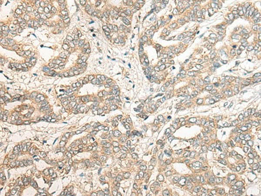 Anti-Human PCDHGB5 Antibody - ABMIUM