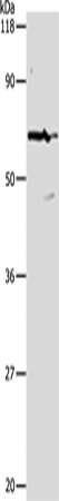 Anti-Human/Mouse/Rat PKM2 Antibody - ABMIUM