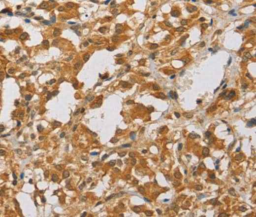 Anti-Human ARHGEF5 Antibody