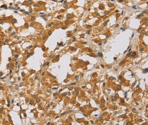 Anti-Human ARHGEF5 Antibody - ABMIUM