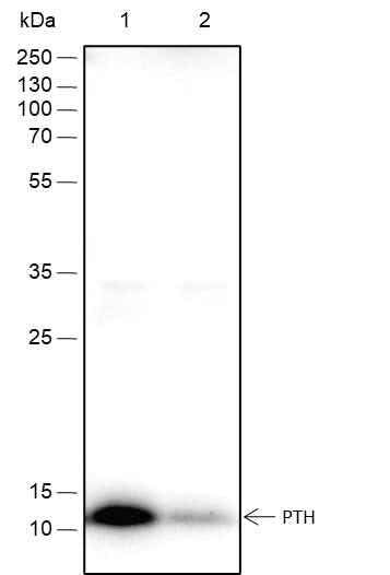 Anti-Rat/Mouse PTH Antibody [A345] - ABMIUM