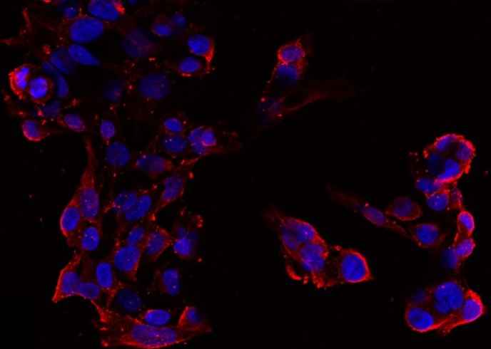Anti-Human CHGA Antibody [A1183] - ABMIUM