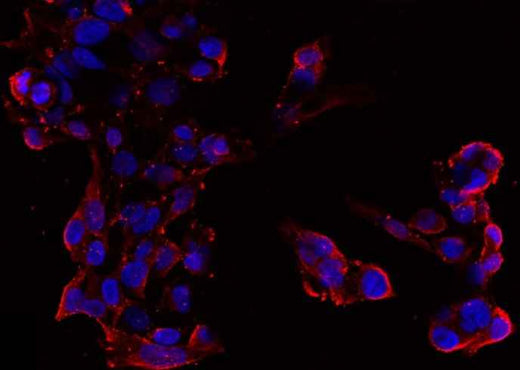 Anti-Human CHGA Antibody [A1183] - ABMIUM
