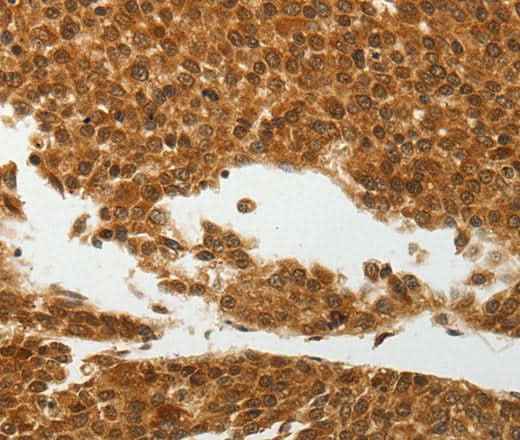 Anti-Human/Mouse SOCS7 Antibody