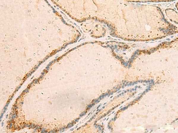 Anti-Human IP6K3 Antibody