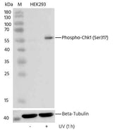 Anti-Human CHEK1 Antibody [B306]