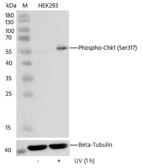 Anti-Human CHEK1 Antibody [B306] - ABMIUM