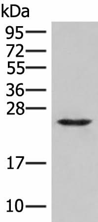 Western blot analysis of Human fetal brain tissue lysate using MRAS Polyclonal Antibody at dilution of 1:400