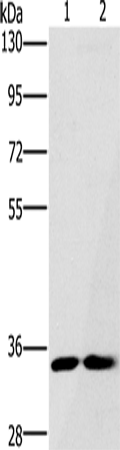 Anti-Human/Mouse/Rat FAIM2 Antibody - ABMIUM