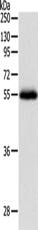 Anti-Human/Mouse/Rat NPY1R Antibody - ABMIUM