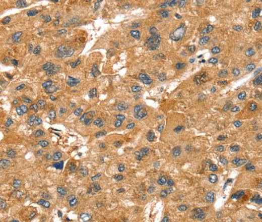 Anti-Human/Mouse/Rat SPTAN1 Antibody