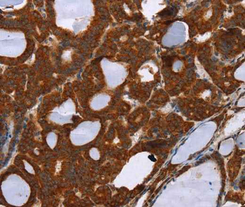 Anti-Human/Mouse/Rat PPP2R3C Antibody
